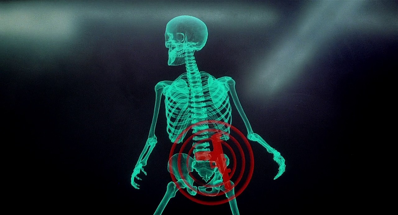Day bones. Рентген. Сканер скелета. Скелет рентген. Рентген человека.
